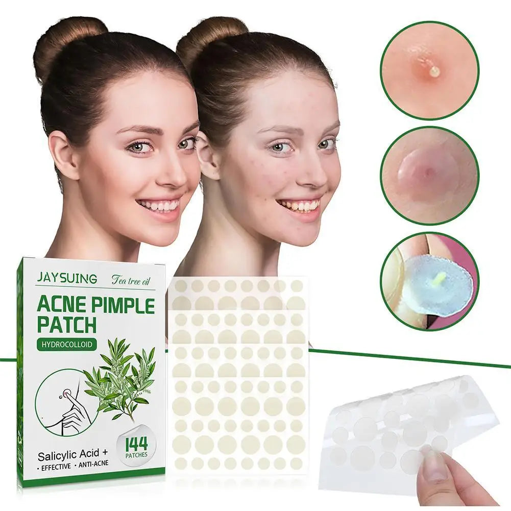 144 ACNE PIMPLE PATCHES Translucent Matte Hydrocolloid Salicylic Acid Tea Tree Oil For Inflamed Acne Improve Whiteheads